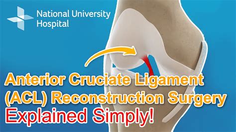 acl surgery greenwich|Anterior cruciate ligament (ACL) treatment.
